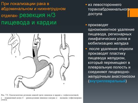 Последствия оперативного вмешательства