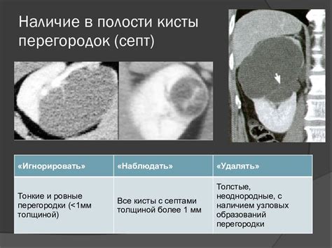 Последствия остаточной полости кисты