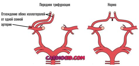 Последствия отсутствия кровотока в узле