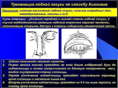 Последствия отсутствия развития правой лобной пазухи