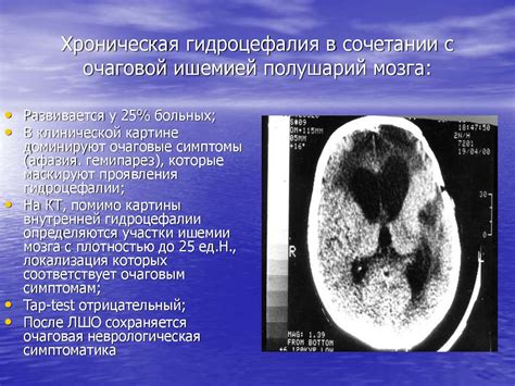 Последствия очаговой травмы головного мозга