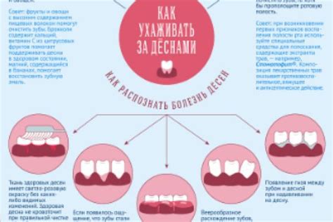 Последствия плохого ухода за деснами