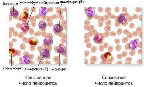 Последствия повышения числа лейкоцитов