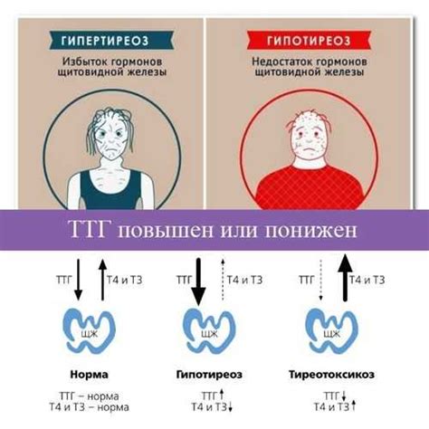 Последствия пониженного уровня гормона Т4 свободного