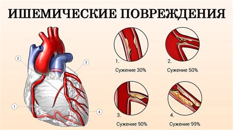 Последствия преимущественного поражения сердца