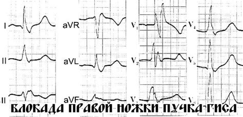 Последствия свесившихся ножек