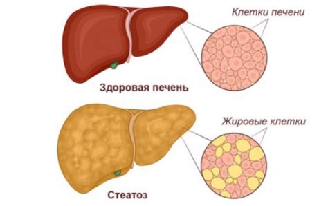 Последствия уплотненной печени