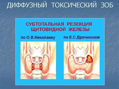 Последствия усиления кровотока щитовидной железы