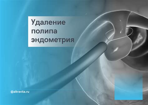 Последствия фрагментов полипа эндометрия для здоровья