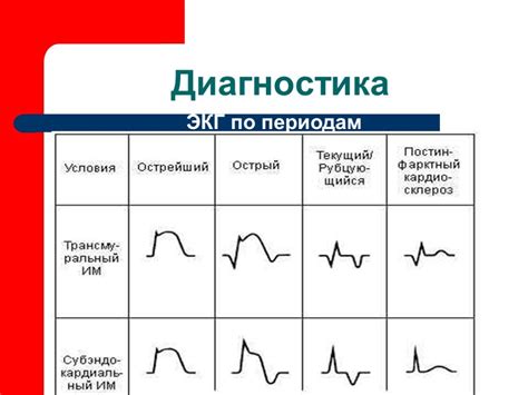 Потенциальные мотивы сна об инфаркте миокарда