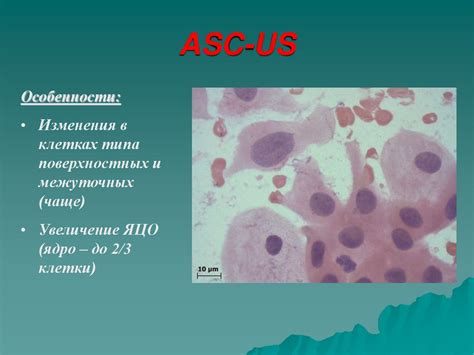 Потенциальные осложнения цитологии ASC-US