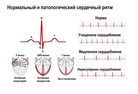 Почему бывает интенсивное сердцебиение: факторы и симптомы