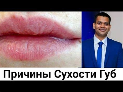 Почему бывает покалываение верхней губы: частые причины и их решения