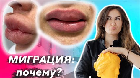 Почему возникает жжение на губах?