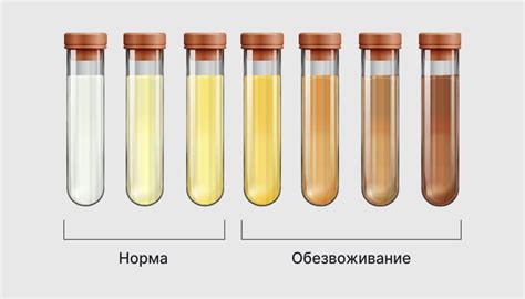 Почему меняется цвет мочи: факторы и последствия