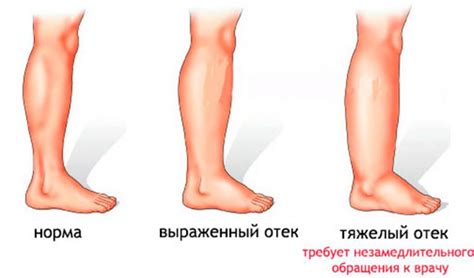 Почему ноги могут гореть и что это означает?