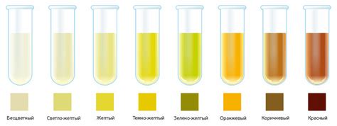 Почему полная прозрачность мочи не всегда является нормой