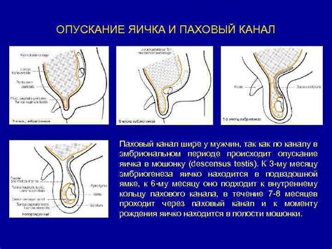 Почему происходит опускание левого яичка ниже правого и что это свидетельствует