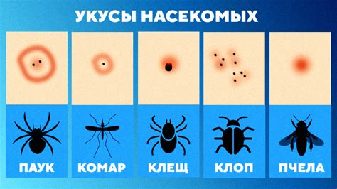 Почему происходит укус щеки?