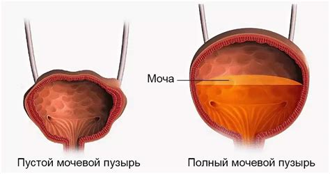 Почему пузырь всегда вздутый или полный?