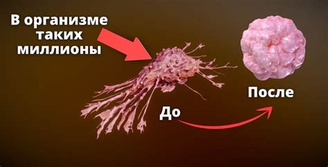 Почему трихомониаз сложно вылечить?