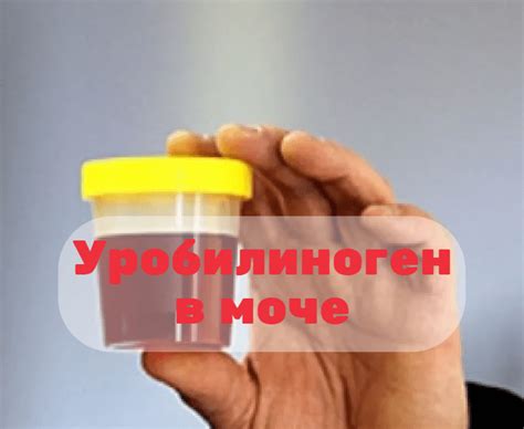 Почему уровень уробилиногена может быть низким