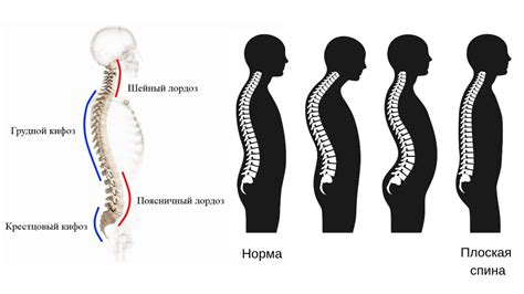 Почему физиологический поясничный лордоз важен для организма?