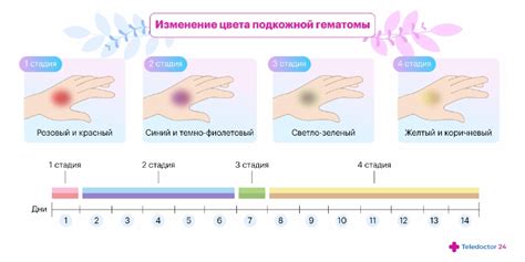 Появление синяков без ударов: