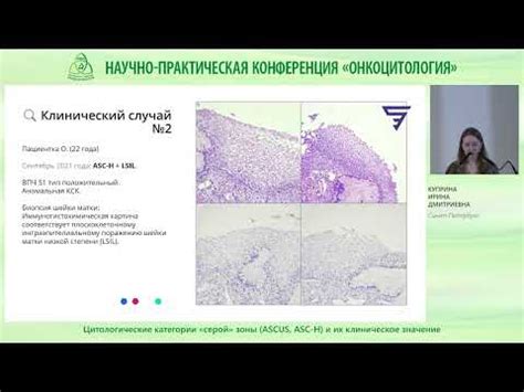 Практическое применение и исследования плоских клеток эпителия