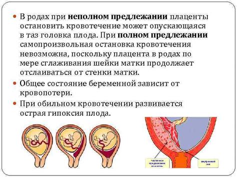 Предлежание хориона: определение и причины