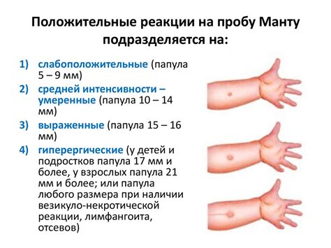 Предосторожности при проведении манту