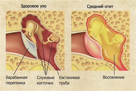 Предотвращение возникновения проблемы с ушами при глотании