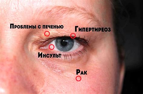 Предупреждение о предстоящей опасности: подсознательные сигналы левого глаза в субботу