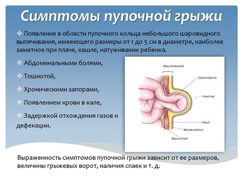 Предупреждение пупочной грыжи