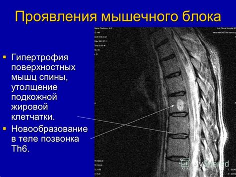 Преимущества блока позвонка