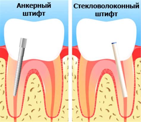 Преимущества выращивания зуба