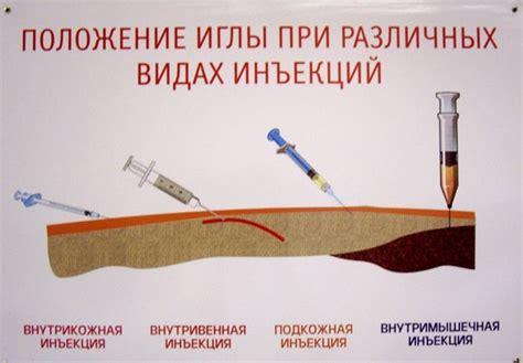 Преимущества нитевых коллагеновых инъекций