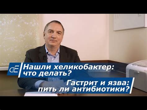 Преимущества уреазного теста