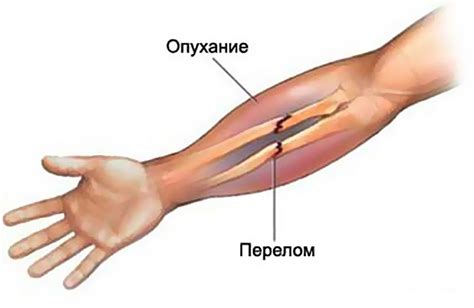 Признаки "легкой руки"