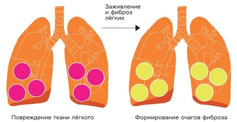 Признаки изменений легких, требующие внимания