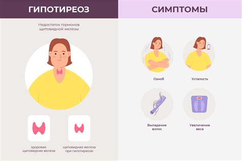 Признаки негрубых общемозговых изменений