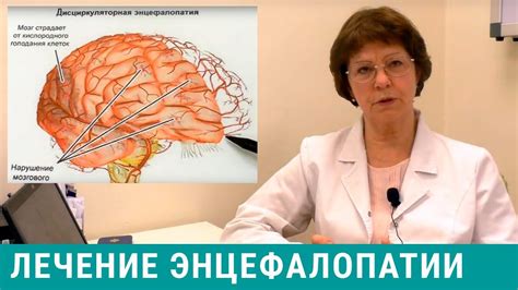 Признаки энцефалопатии головного мозга: симптомы и диагностика