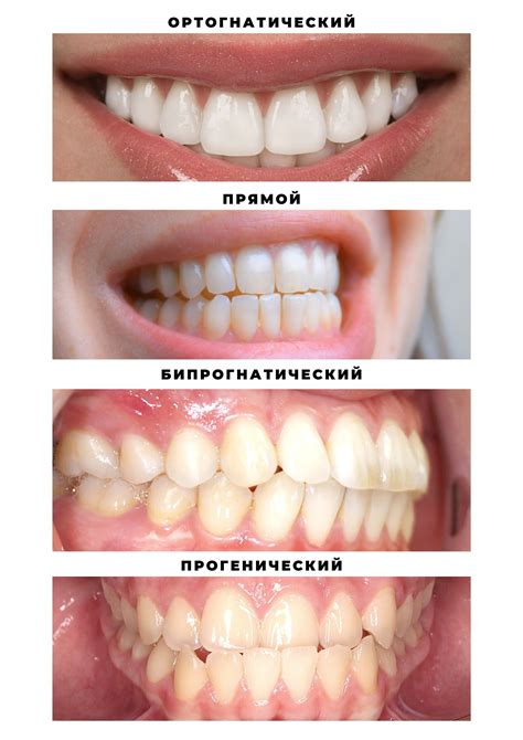 Прикус ножницы у щенка: что это такое?