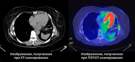 Применение МТС легких в медицине