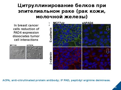 Применение онкоцитологии при плоском эпителиальном раке