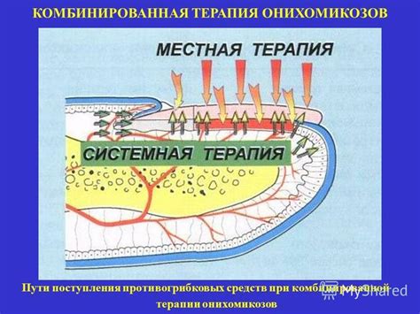 Принцип действия местных препаратов