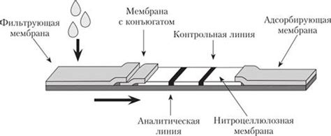 Принцип работы Лахман теста