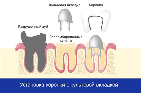 Принцип работы культевой вкладки