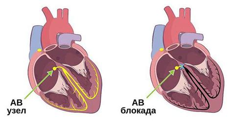 Причины внутриназальной блокады