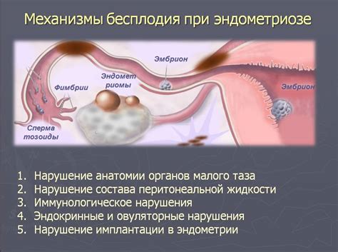 Причины возникновения внутреннего эндометриоза